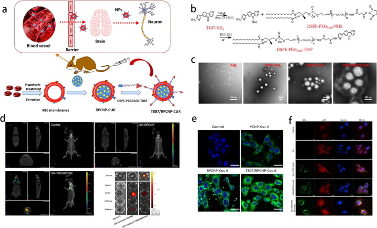 Cell membrane-camouflaged PLGA biomimetic system for diverse biomedical application.