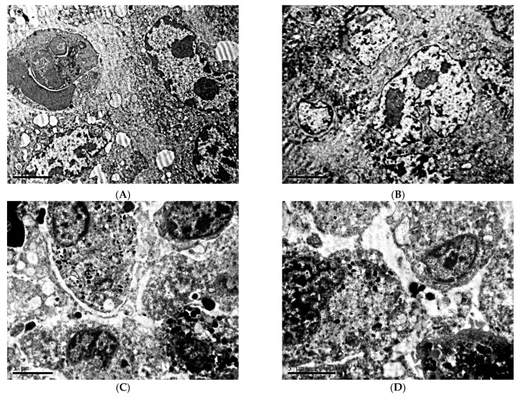 Characteristic of Ultrastructure of Mice B16 Melanoma Cells under the Influence of Different Lighting Regimes.