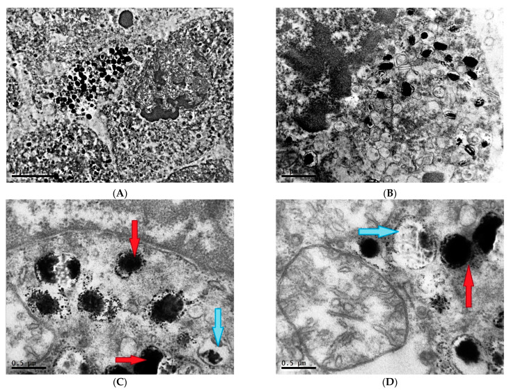 Characteristic of Ultrastructure of Mice B16 Melanoma Cells under the Influence of Different Lighting Regimes.