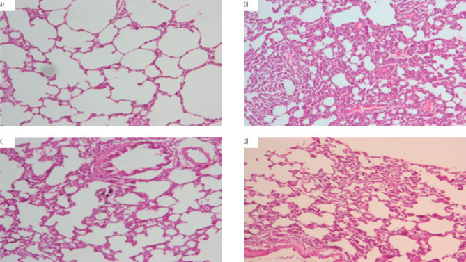 Exposure to particulate matter 2.5 leading to lung microbiome disorder and the alleviation effect of <i>Auricularia auricular-judae</i> polysaccharide.