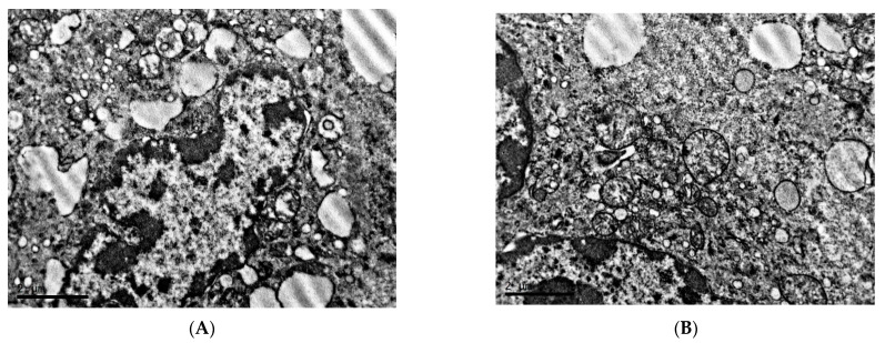 Characteristic of Ultrastructure of Mice B16 Melanoma Cells under the Influence of Different Lighting Regimes.