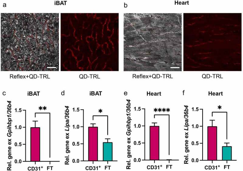 Lysosomal acid lipase promotes endothelial proliferation in cold-activated adipose tissue.