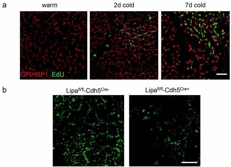 Lysosomal acid lipase promotes endothelial proliferation in cold-activated adipose tissue.