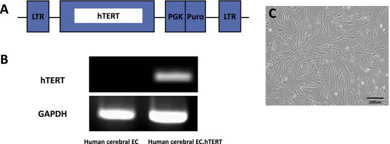 Improvement of erectile dysfunction using endothelial progenitor cells from fetal cerebral vasculature in the cavernous nerve injury of rats.