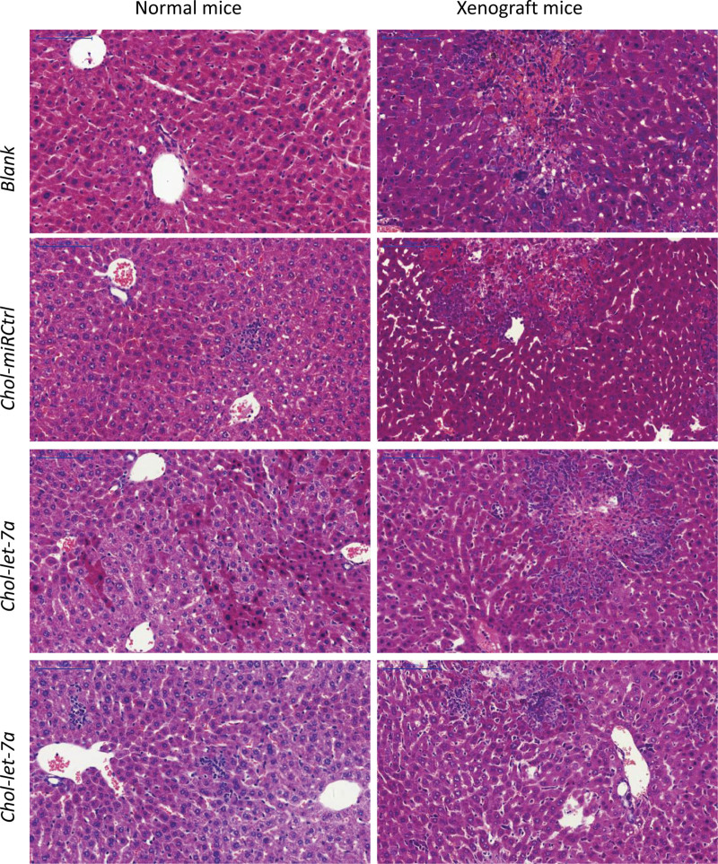 Antitumor and off-target effects of cholesterol-conjugated let-7a mimics in an orthotopic hepatocellular carcinoma xenograft nude mouse model.