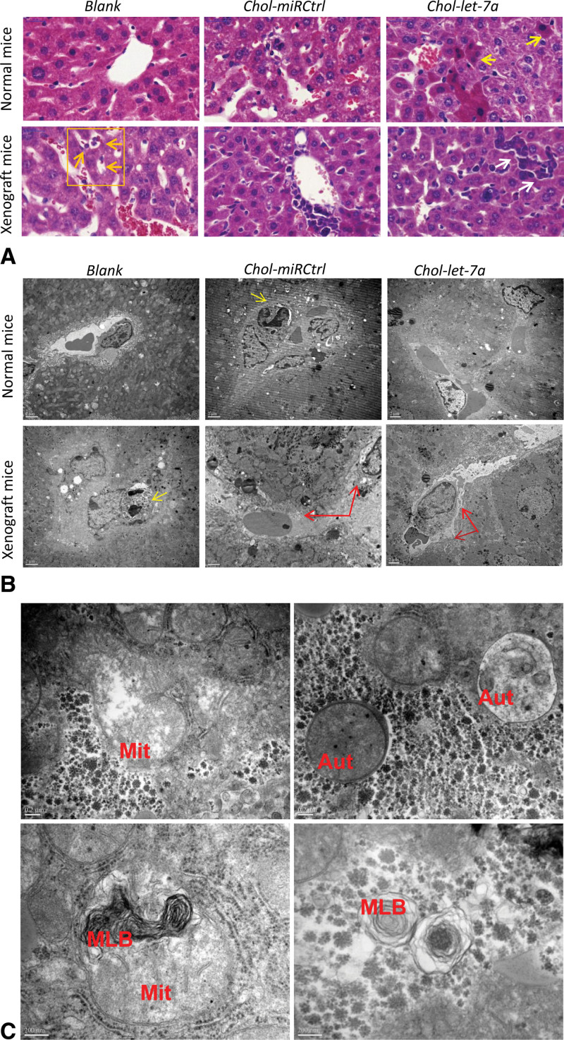 Antitumor and off-target effects of cholesterol-conjugated let-7a mimics in an orthotopic hepatocellular carcinoma xenograft nude mouse model.