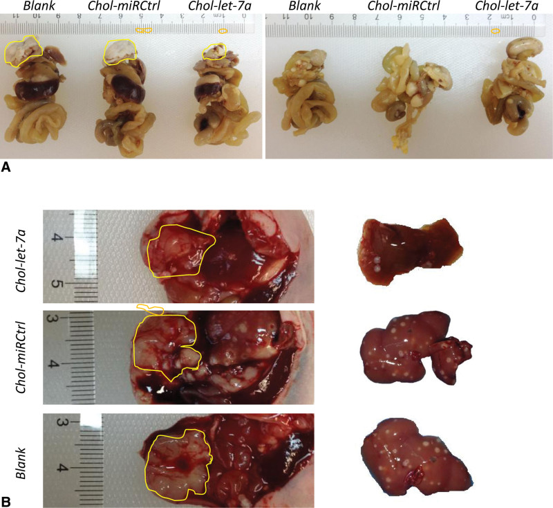 Antitumor and off-target effects of cholesterol-conjugated let-7a mimics in an orthotopic hepatocellular carcinoma xenograft nude mouse model.