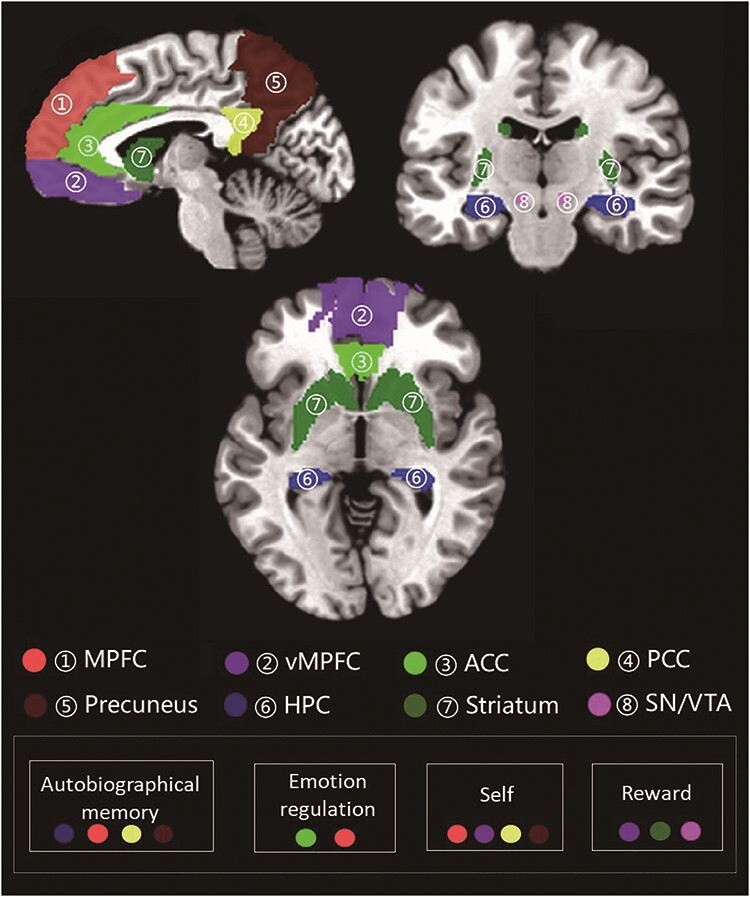 Patterns of brain activity associated with nostalgia: a social-cognitive neuroscience perspective.