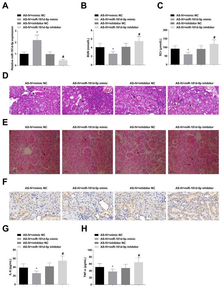 Astragaloside IV improves renal function and alleviates renal damage and inflammation in rats with chronic glomerulonephritis.