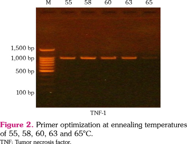 Association of tumor necrosis factor-alpha promoter region gene polymorphism at positions -308G/A, -857C/T, and -863C/A with etanercept response in Iraqi rheumatoid arthritis patients.