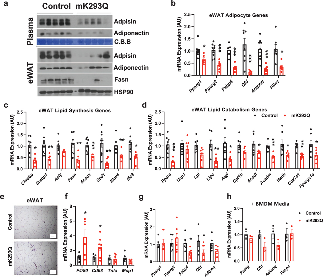 Acetylation of PPARγ in macrophages promotes visceral fat degeneration in obesity.