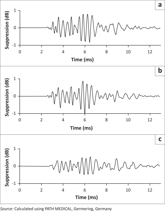 Contralateral suppression of transient evoked otoacoustic emissions in adults: A normative study.