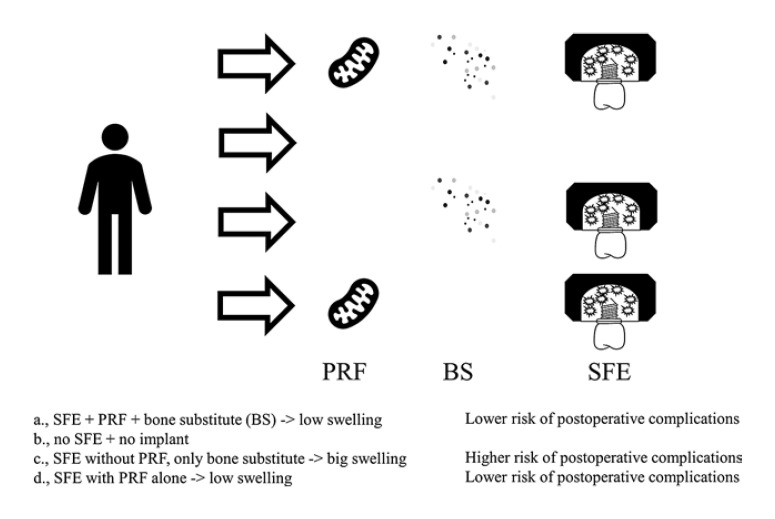 Platelet-Rich Fibrin in Oral Surgery and Implantology: A Narrative Review.