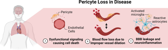 Pericyte infection by HIV-1: a fatal attraction.