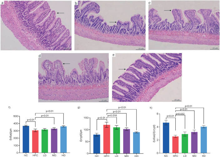 The Effects of a High-Fat/Cholesterol Diet on the Intestine of Rats Were Attenuated by <i>Sparassis latifolia</i> Polysaccharides.