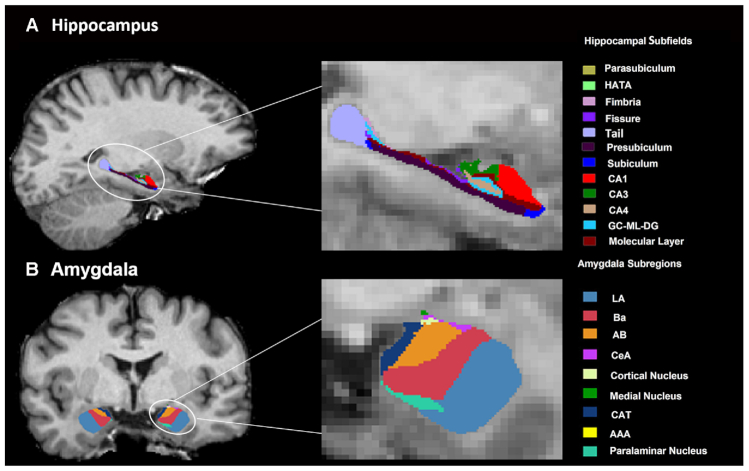 Structural covariance network of the hippocampus-amygdala complex in medication-naïve patients with first-episode major depressive disorder.