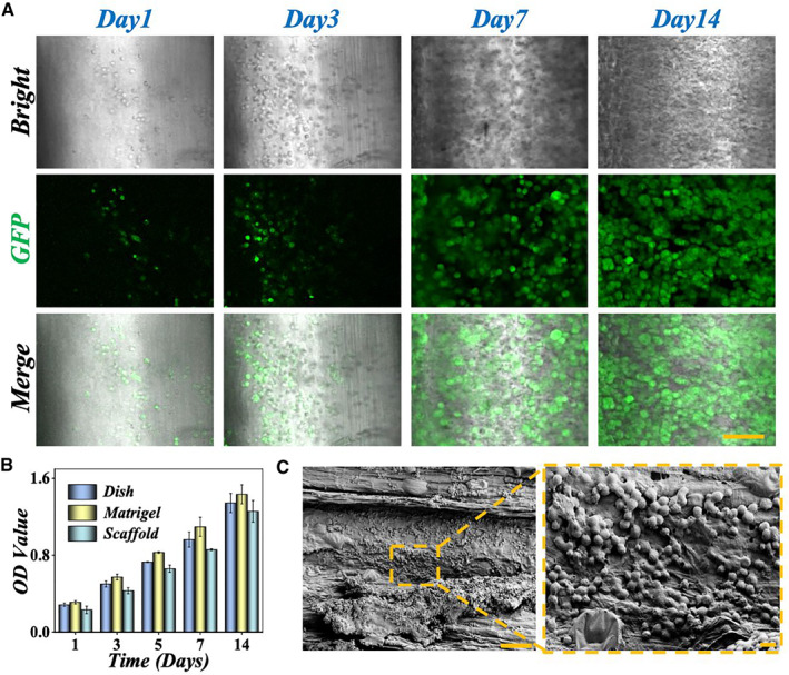 Celery-derived scaffolds with liver lobule-mimicking structures for tissue engineering transplantation.