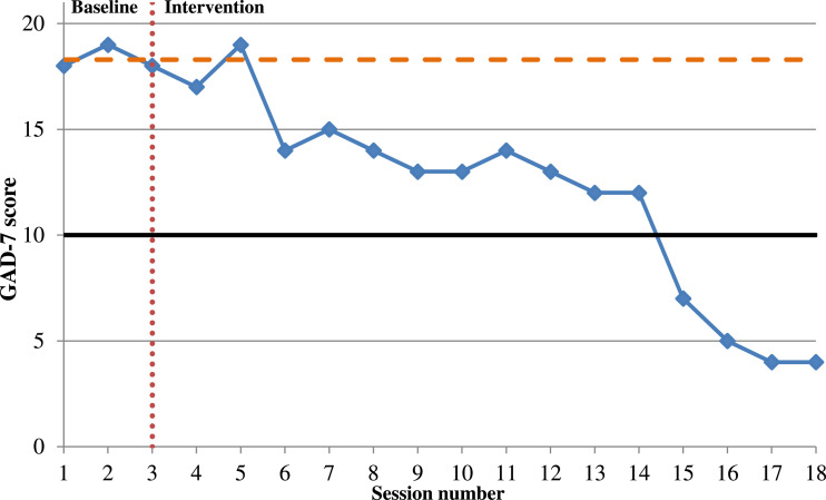 A Case Report of Home-Based Cognitive-Behavioural Treatment for Late-Onset Post-Traumatic Stress Disorder, Triggered by Mask-Wearing in the Context of the COVID-19 Pandemic.