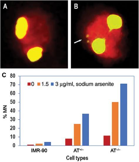 Oxidative Damage Induced Telomere Mediated Genomic Instability in Cells from Ataxia Telangiectasia Patients.