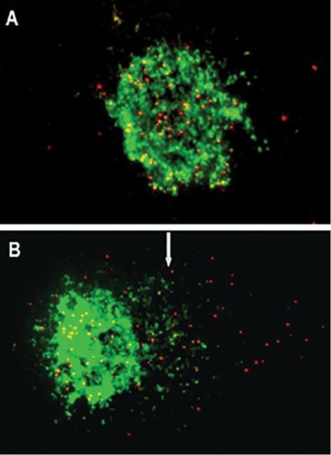 Oxidative Damage Induced Telomere Mediated Genomic Instability in Cells from Ataxia Telangiectasia Patients.