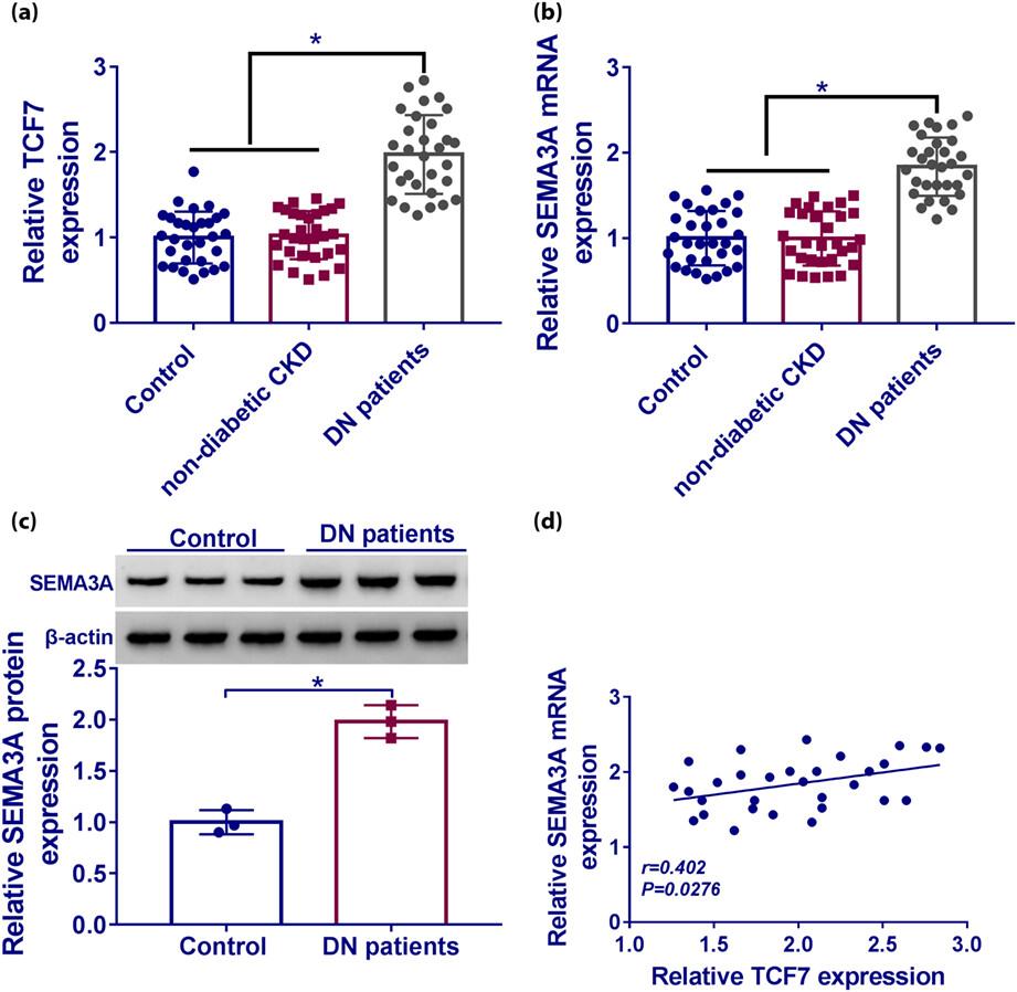LncRNA TCF7 contributes to high glucose-induced damage in human podocytes by up-regulating SEMA3A via sponging miR-16-5p
