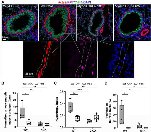 Myocd regulates airway smooth muscle cell remodeling in response to chronic asthmatic injury