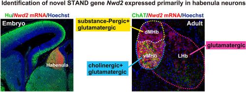 Identification and expression profile of novel STAND gene Nwd2 in the mouse central nervous system