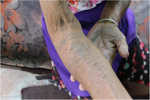 Embodying dependency: Caribbean godna (tattoos) as female subordination and resistance