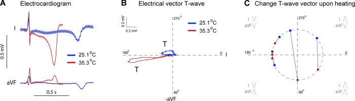 Catecholamines are key modulators of ventricular repolarization patterns in the ball python (Python regius).