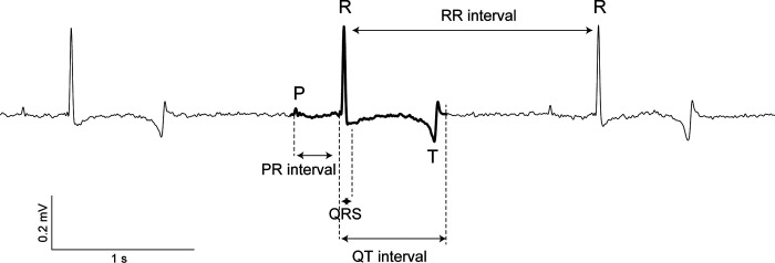 Catecholamines are key modulators of ventricular repolarization patterns in the ball python (Python regius).