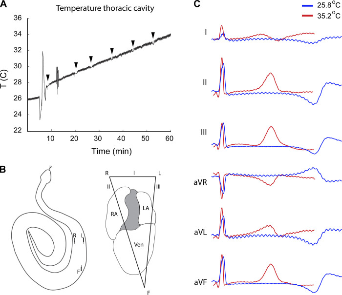 Catecholamines are key modulators of ventricular repolarization patterns in the ball python (Python regius).