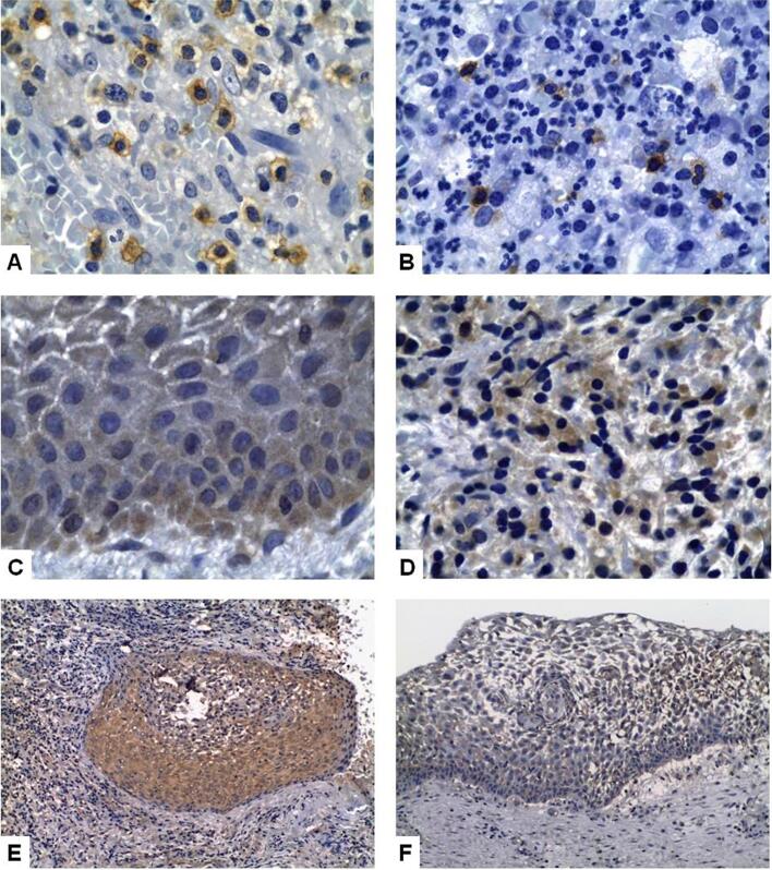 Expression of epithelial growth factors and of apoptosis-regulating proteins, and presence of CD57+ cells in the development of inflammatory periapical lesions.