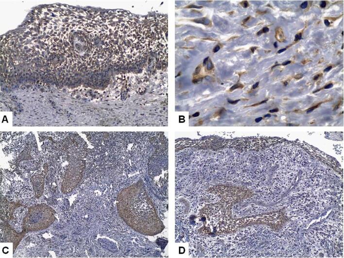 Expression of epithelial growth factors and of apoptosis-regulating proteins, and presence of CD57+ cells in the development of inflammatory periapical lesions.