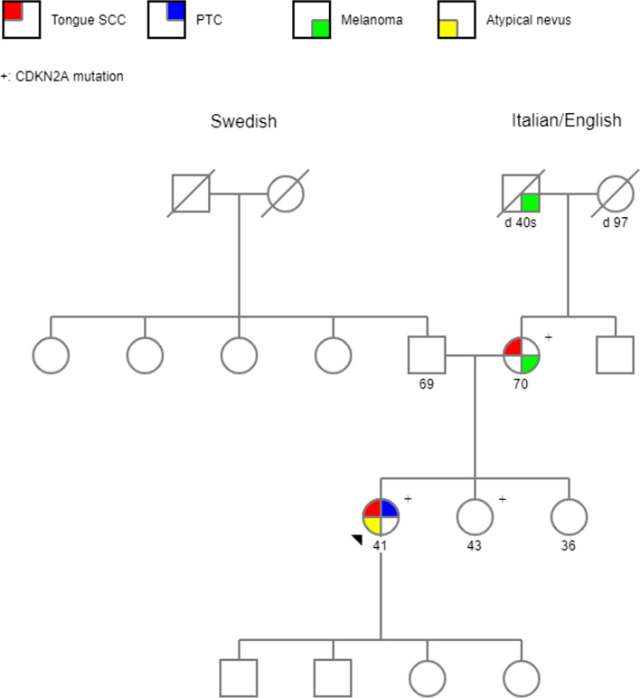 Hereditary oral squamous cell carcinoma associated with CDKN2A germline mutation: a case report.