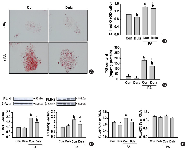 Dulaglutide Ameliorates Palmitic Acid-Induced Hepatic Steatosis by Activating FAM3A Signaling Pathway.
