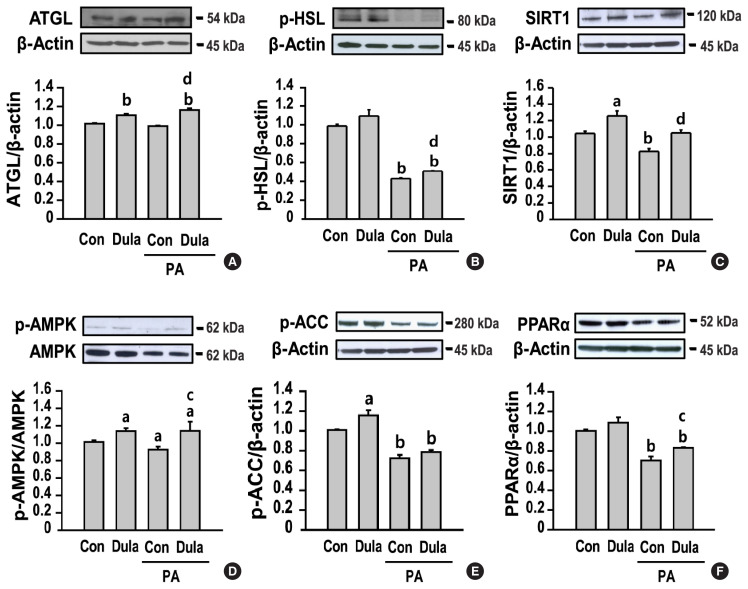 Dulaglutide Ameliorates Palmitic Acid-Induced Hepatic Steatosis by Activating FAM3A Signaling Pathway.