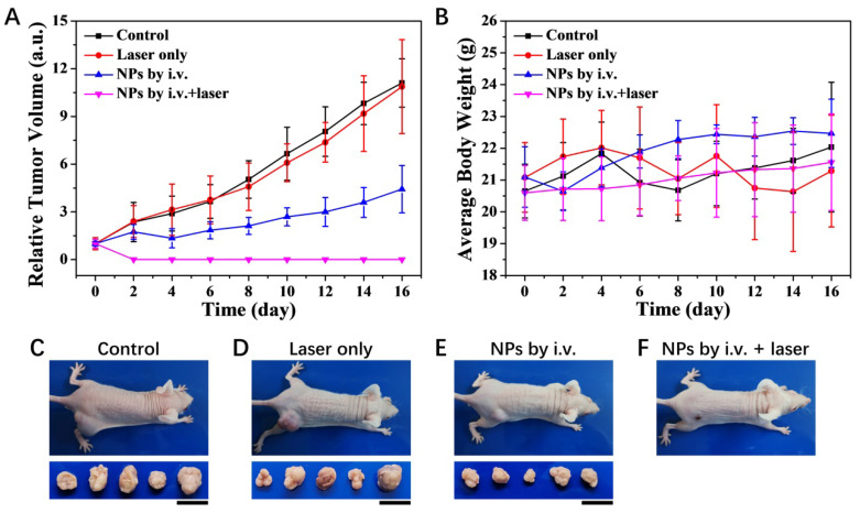 Erratum: Tumor Theranostics of Transition Metal Ions Loaded Polyaminopyrrole Nanoparticles: Erratum.