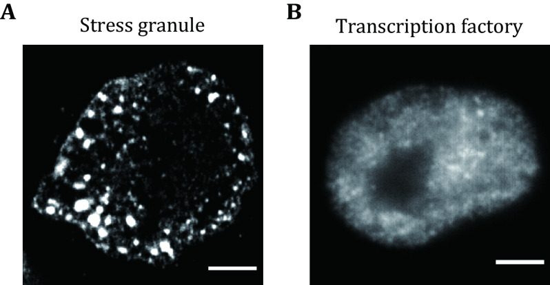 Characterization of liquid-liquid phase separation using super-resolution and single-molecule imaging.