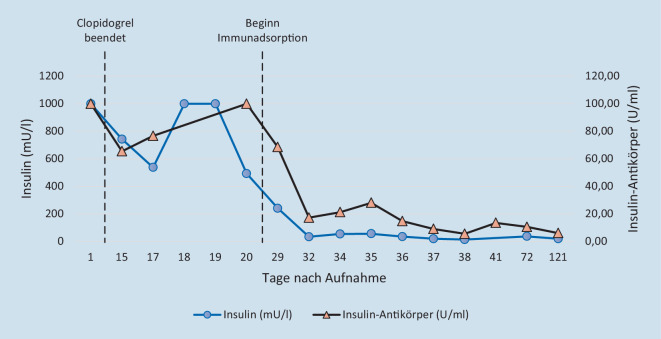 [Insulin autoimmune syndrome : A rare, but important differential diagnosis of hypoglycemia].