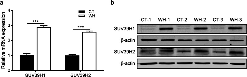 SUV39H1 regulates corneal epithelial wound healing via H3K9me3-mediated repression of p27.