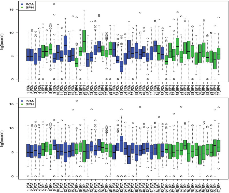 MicroRNAs from urinary exosomes as alternative biomarkers in the differentiation of benign and malignant prostate diseases.