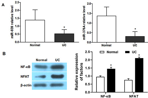 Effects of miR-939 and miR-376A on ulcerative colitis using a decoy strategy to inhibit NF-κB and NFAT expression.