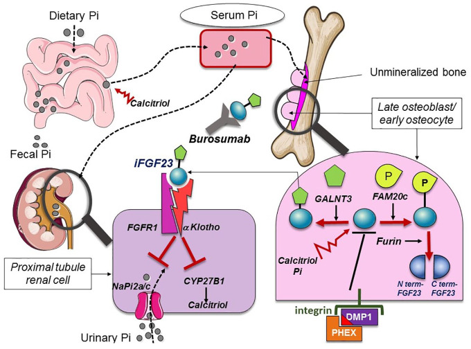 What are the benefits of the anti-FGF23 antibody burosumab on the manifestations of X-linked hypophosphatemia in adults in comparison with conventional therapy? A review.