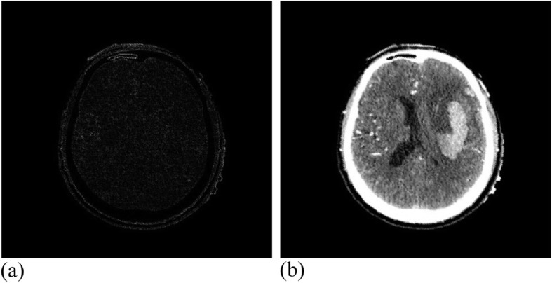 Non-rigid registration of medical images based on [Formula: see text] non-tensor product B-spline.