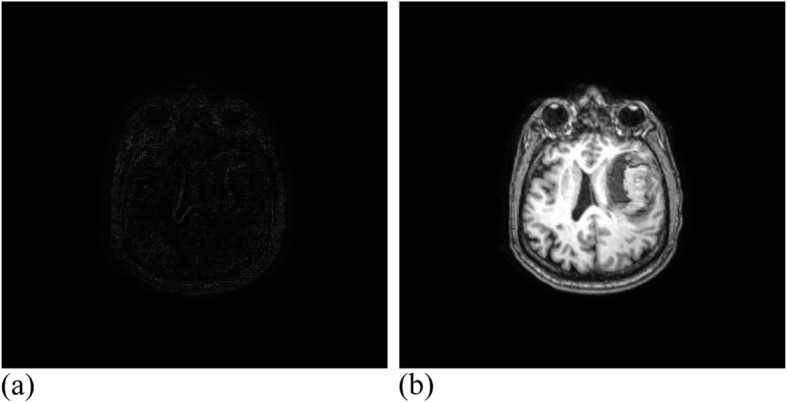 Non-rigid registration of medical images based on [Formula: see text] non-tensor product B-spline.