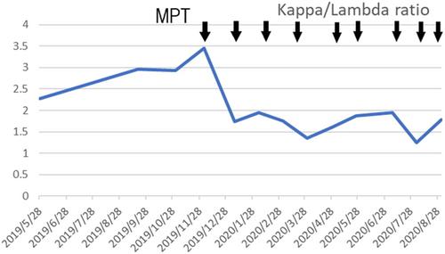 Gastric amyloidosis associated with multiple myeloma: A rare cause of upper gastrointestinal bleeding