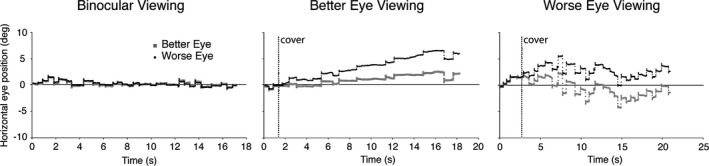 Binocular visual function and fixational control in patients with macular disease: A review.