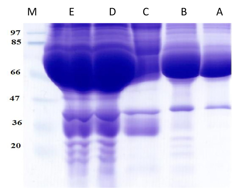 The effect of homocysteine thiolactone on paraoxonase and aryl esterase activity of human serum purified paraoxonase 1 in vitro experiments.