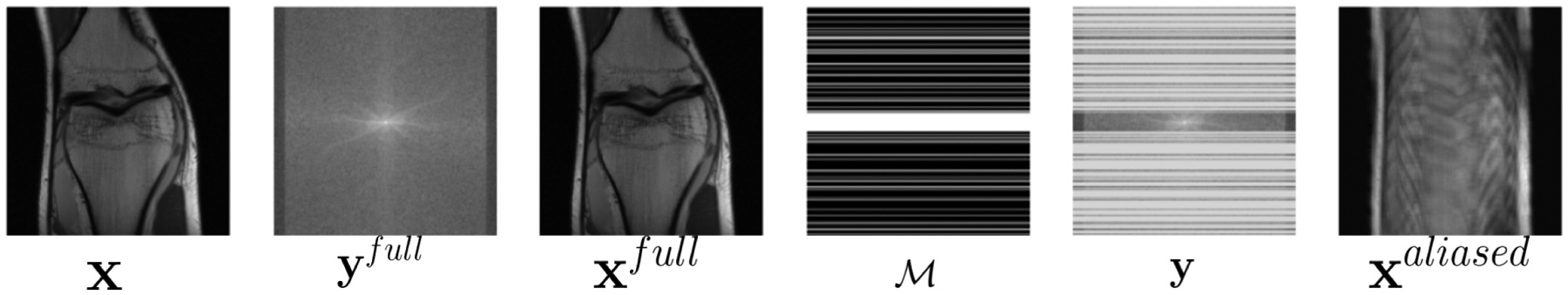 A review and experimental evaluation of deep learning methods for MRI reconstruction.