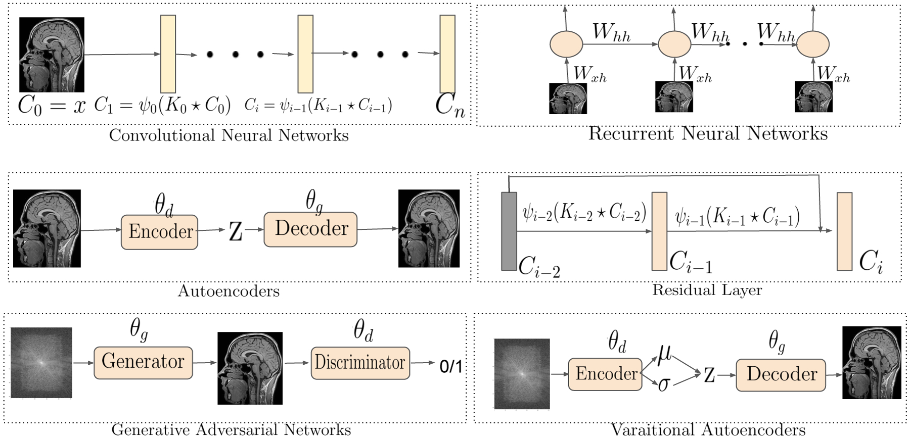 A review and experimental evaluation of deep learning methods for MRI reconstruction.